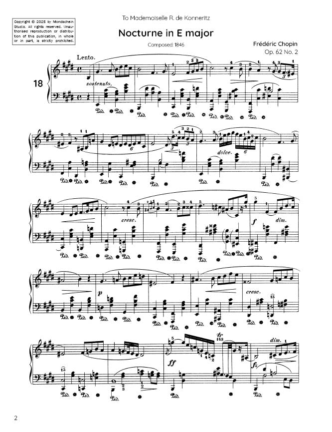 Chopin - Nocturne No. 18, Op. 62 No. 2 (PDF Sheet Music / Digital Download)
